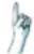 IGNIS ADL 351 - 3'Entsorgung - 1