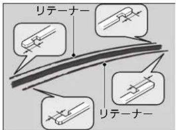 リテーナー リテーナー