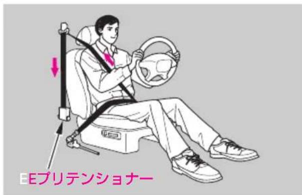 EEプリテンショナー