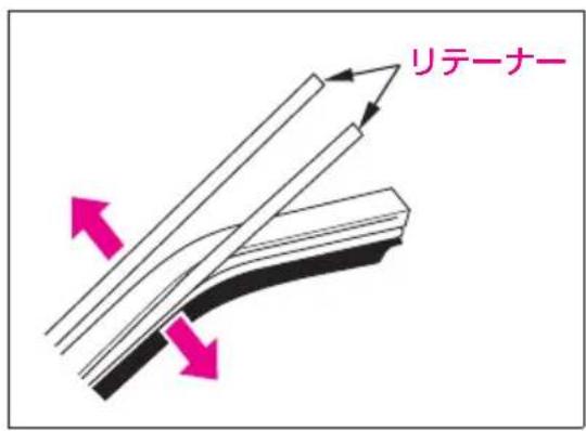 リテーナー