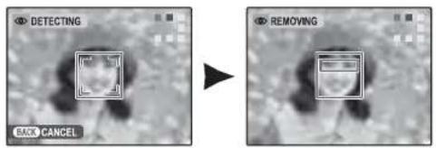 DETECTING BACK CANCEL REMOVING
