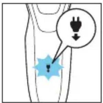Diagram showing a medical or anatomical location with a highlighted defect and an electrical plug icon pointing to it.