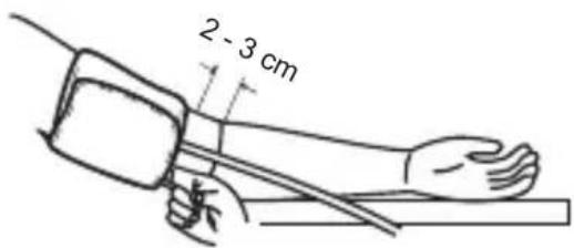 2 - 3 cm