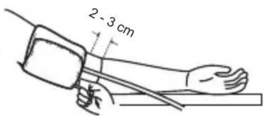 2 - 3 cm
