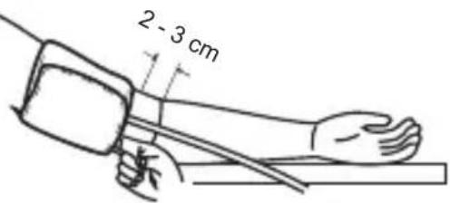 2 - 3 cm