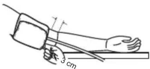 3 cm