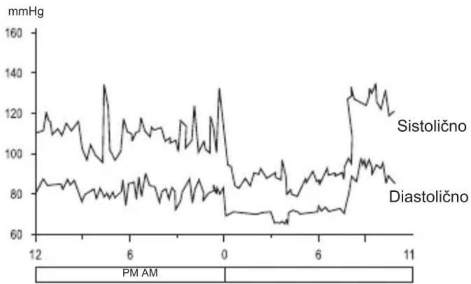 Geratherm Smart - Zakaj moj krvni tlak skozi dan niha? - 1