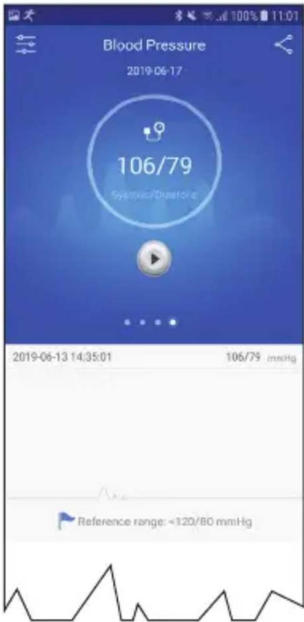 Blood Pressure 2019-06-17 106/79 Systolic/Quartzite 2019-06-13 14:35:01 106/79 mmHg Reference range: ~120/80 mmHg