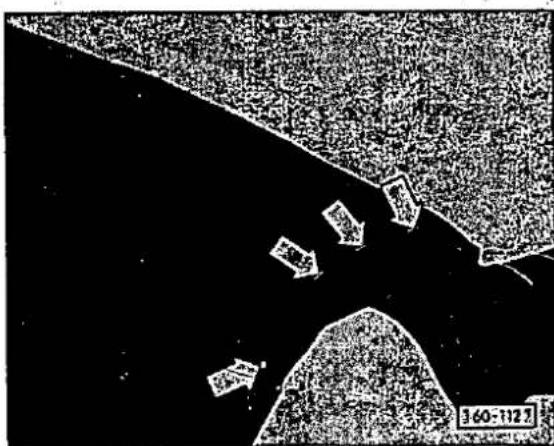 360-1125