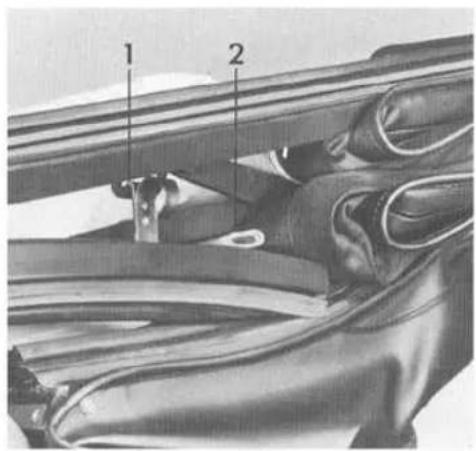 Medical diagram showing anatomical structures with labeled parts 1 and 2, likely from a surgical or radiographic procedure.