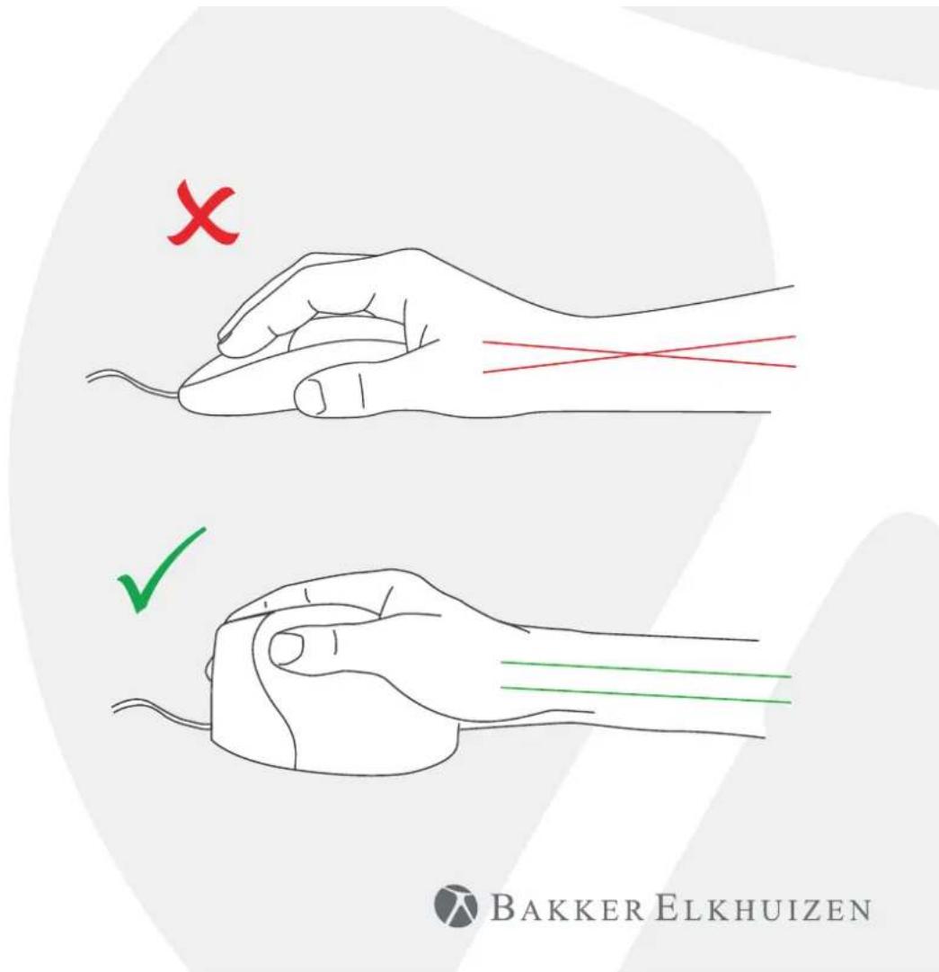 X ✓ BAKKER ELKHUIZEN