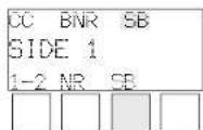 BECKER Mercedes Benz Audio 10 - Cassetteweergave - 3