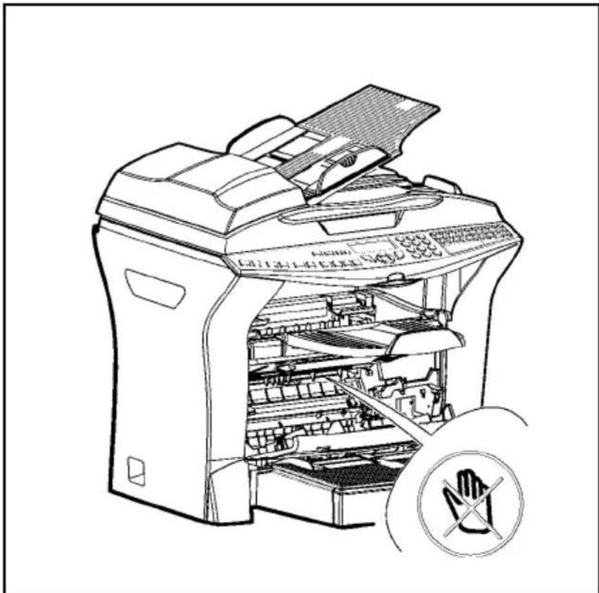 SAGEM MFP 580 - Drumcassette (OPC) vervangen - 2