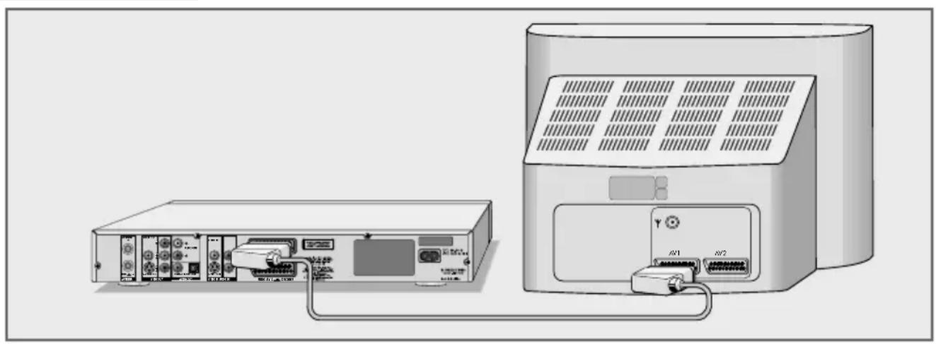 GRUNDIG GDR 5550 HDD - Televisietoestel aansluiten - 1