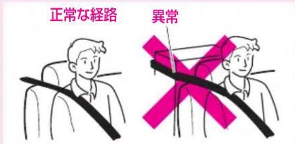 正常な経路 異常