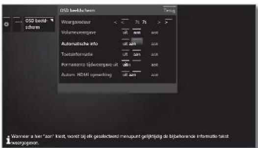 LOEWE Reference ID 55 - Automatisch informatievenster permanent in- of uitschakelen - 2
