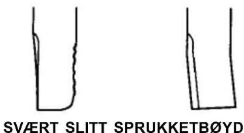 SVÆRT SLITT SPRUKKETB∅YD