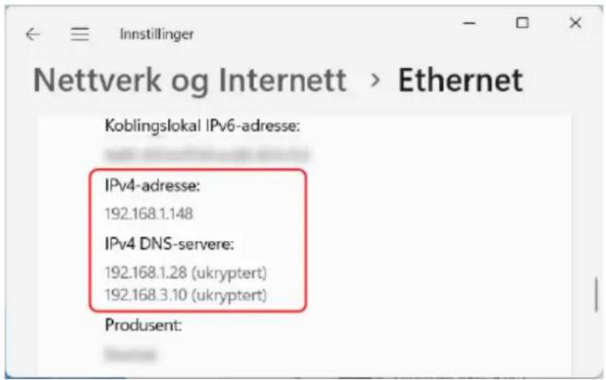 CANON i-SENSYS LBP243dw II - ■Vise IP-adresse og DNS-server - 1