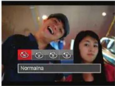 Normalna