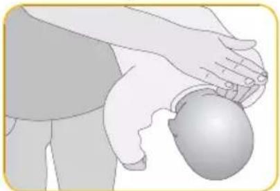 Nanny BM-02 - Wykonaj 3–5 uderzeń w plecy - 1