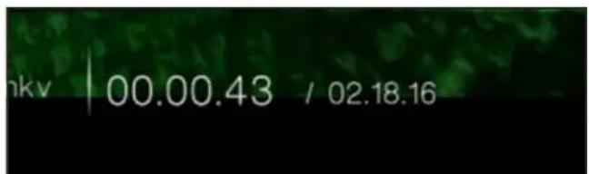 hkv | 00.00.43 / 02.18.16