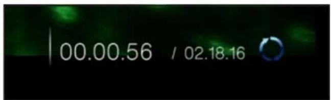 00.00.56 / 02.18.16