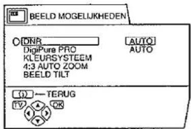 BEELD MOGELJKHEDEN DNR_ DigiPure PRO KLEURSYSTEEM 4:3 AUTO ZOOM BEELD TILT (AUTO) AUTO (1) — TERUG TV A OK