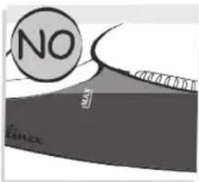 NO MAX Einzex