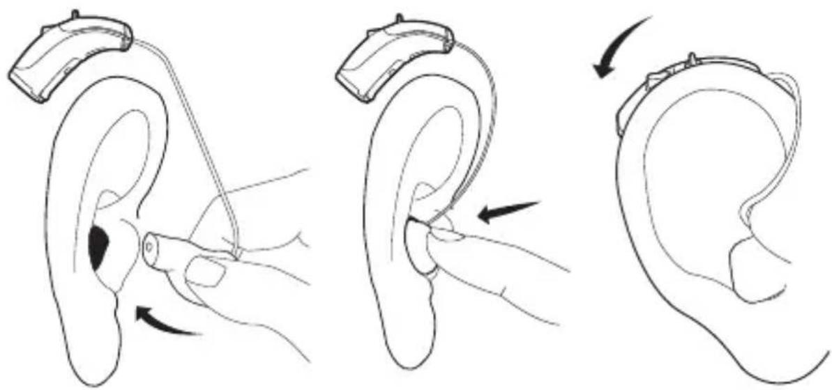 Diagram illustrating ear ear ear ear ear ear ear ear ear ear ear ear ear ear ear ear ear ear ear ear ear ear ear ear ear ear ear ear ear ear ear ear ear ear ear ear ear ear ear ear ear ear ear ear ear ear ear ear ear ear ear ear ear ear ear ear ear ear ear ear ear ear ear ear ear ear ear ear ear ear ear ear ear ear ear ear ear ear ear ear ear ear ear ear ear ear ear ear ear ear ear ear ear ear ear ear ear ear ear ear Ear Ear Ear Ear Ear Ear Ear Ear Ear Ear Ear Ear Ear Ear Ear Ear Ear Ear Ear Ear Ear Ear Ear Ear Ear Ear Ear Ear Ear Ear Ear Ear Ear Ear Ear Ear Ear Ear Ear Ear Ear Ear Ear Ear Ear Ear Ear Ear Ear Ear Ear Ear Ear Ear Ear Ear Ear Ear Ear Ear Ear Ear Ear Ear Ear Ear Ear Ear Ear Ear Ear Ear Ear Ear Ear Ear Ear Ear Ear Ear Ear Ear Ear Ear Ear Ear Ear Ear Ear Ear Ear Ear Ear Ear Ear Ear Ear Ear Ear Earear