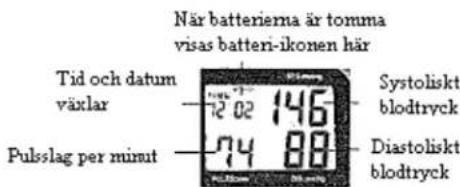 Scala SC 7012 - LCD-skärmen - 1