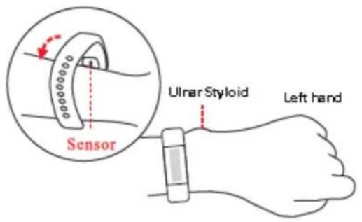 Sensor Ulnar Styloid Left hand