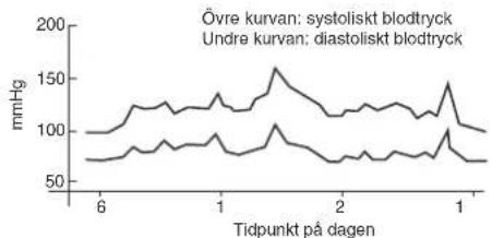 OMRON R6 Intellisense - Varför är det bra att mäta blodtrycket hemma? - 1