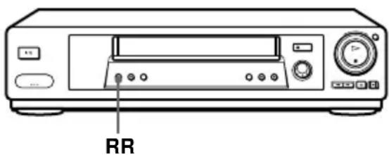 RR