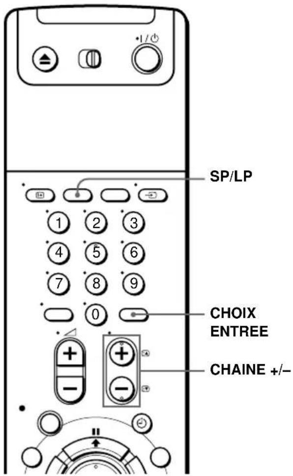 SP/LP CHOIX ENTREE CHAINE +/-