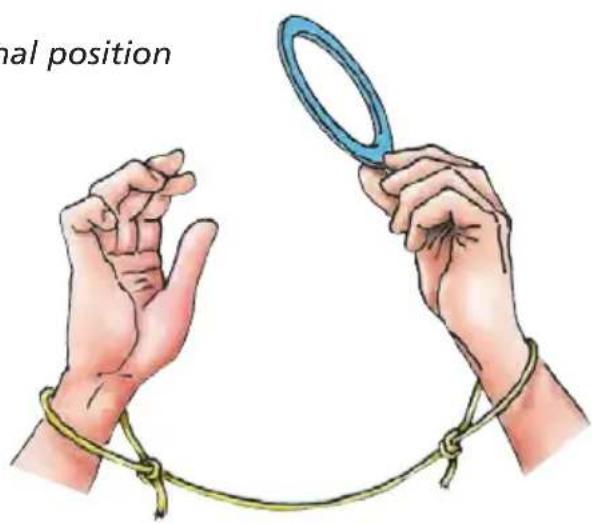 mal position