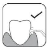 Essentiel B Pulse Confort EJD2 - gebruikstips - 1