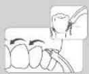 Waterpik WF-20 - Nach dem Gebrauch - 1