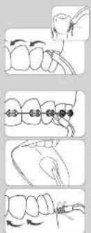 Waterpik WF-20 - When Finished - 1