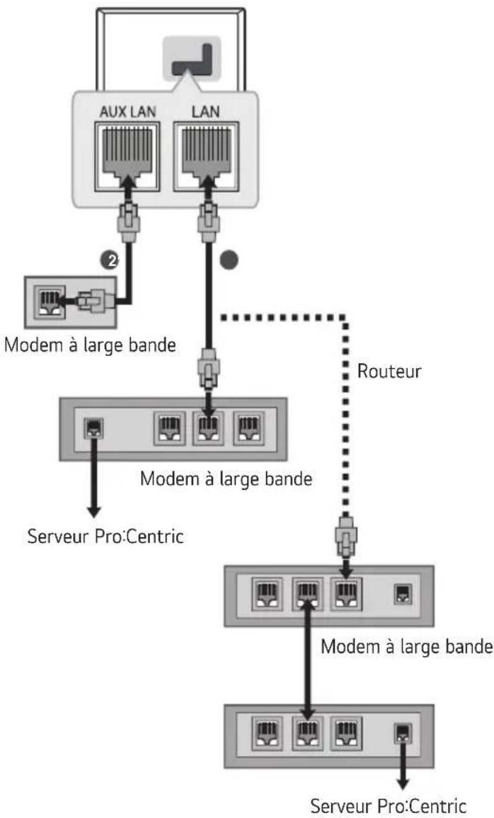 LG 50UK777H0UA - Connexion à un réseau filaire - 1