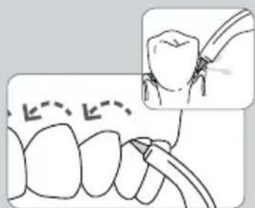 Waterpik WP-583 - Al termine dell'operazione - 2