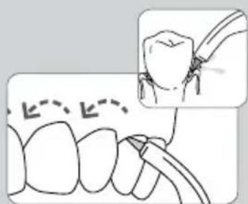Waterpik WP-583 - Ao terminar - 2