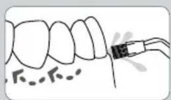 Waterpik WP-583 - Orthodontic-Düse\* - 9