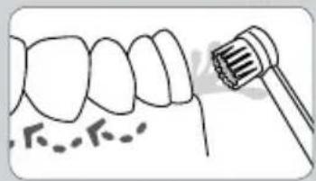 Waterpik WP-583 - Orthodontic-Düse\* - 8