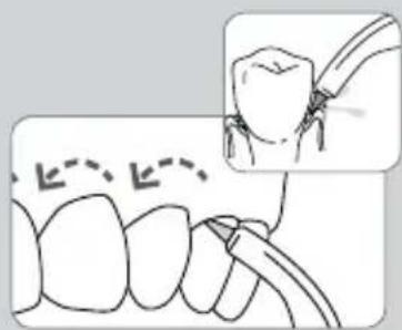 Waterpik WP-583 - Al terminar - 2