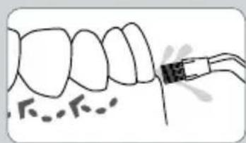 Waterpik WP-583 - PONTAS - 9