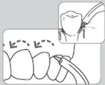 Waterpik WP-583 - Nach Beendigung - 2