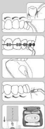 Waterpik WF-310 - Recommended Technique - 1