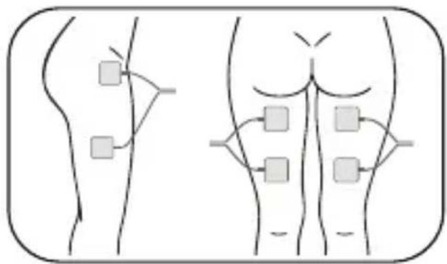Luvion Pelvic Floor Trainer - Electrode Pads Placement - 4