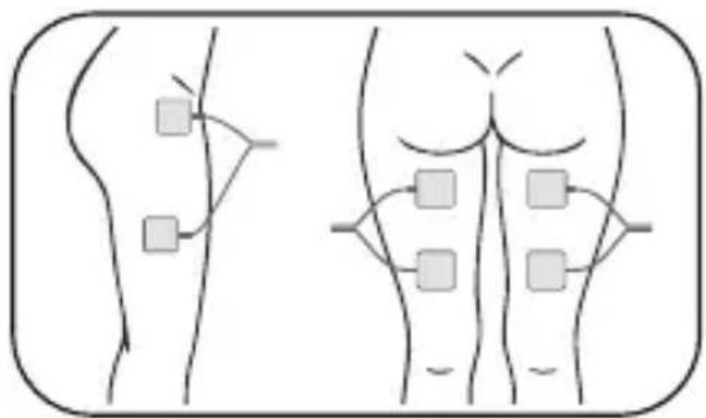 Luvion Pelvic Floor Trainer - Platzierung der Elektropads - 2