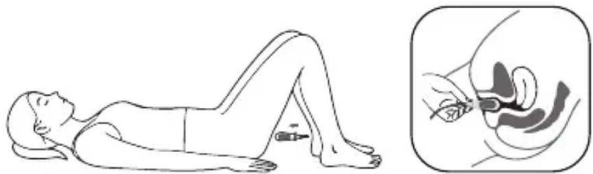 Luvion Pelvic Floor Trainer - Entraînement du plancher pelvien avec la sonde vaginale - 1